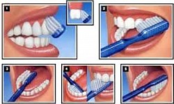 Correct brushing Techniques