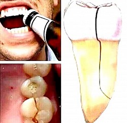 Don't Use your teeth as tools
