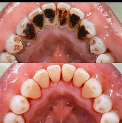 Before and after our services