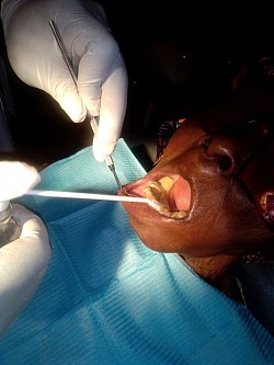 Visit a Dentist regularly for check up
